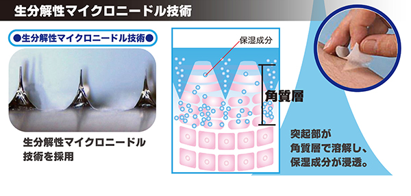 生分解性マイクロニードル技術