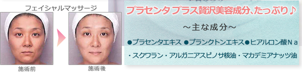 プラセンタ プラス贅沢美容成分、たっぷり