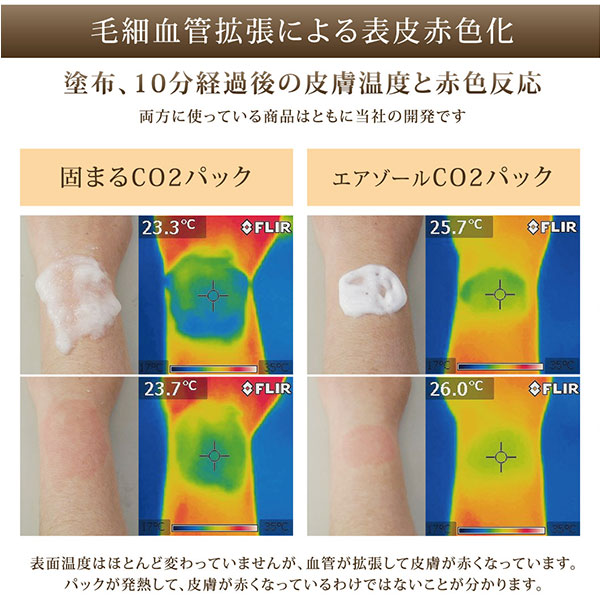 毛細血管拡張による表皮赤色化