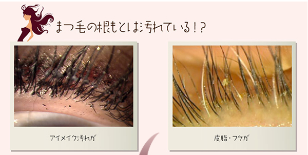 アイシャンプー ロング