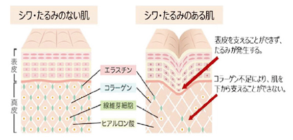 Moi Belle（モベレ） しわ改善美白クリーム（医薬部外品）